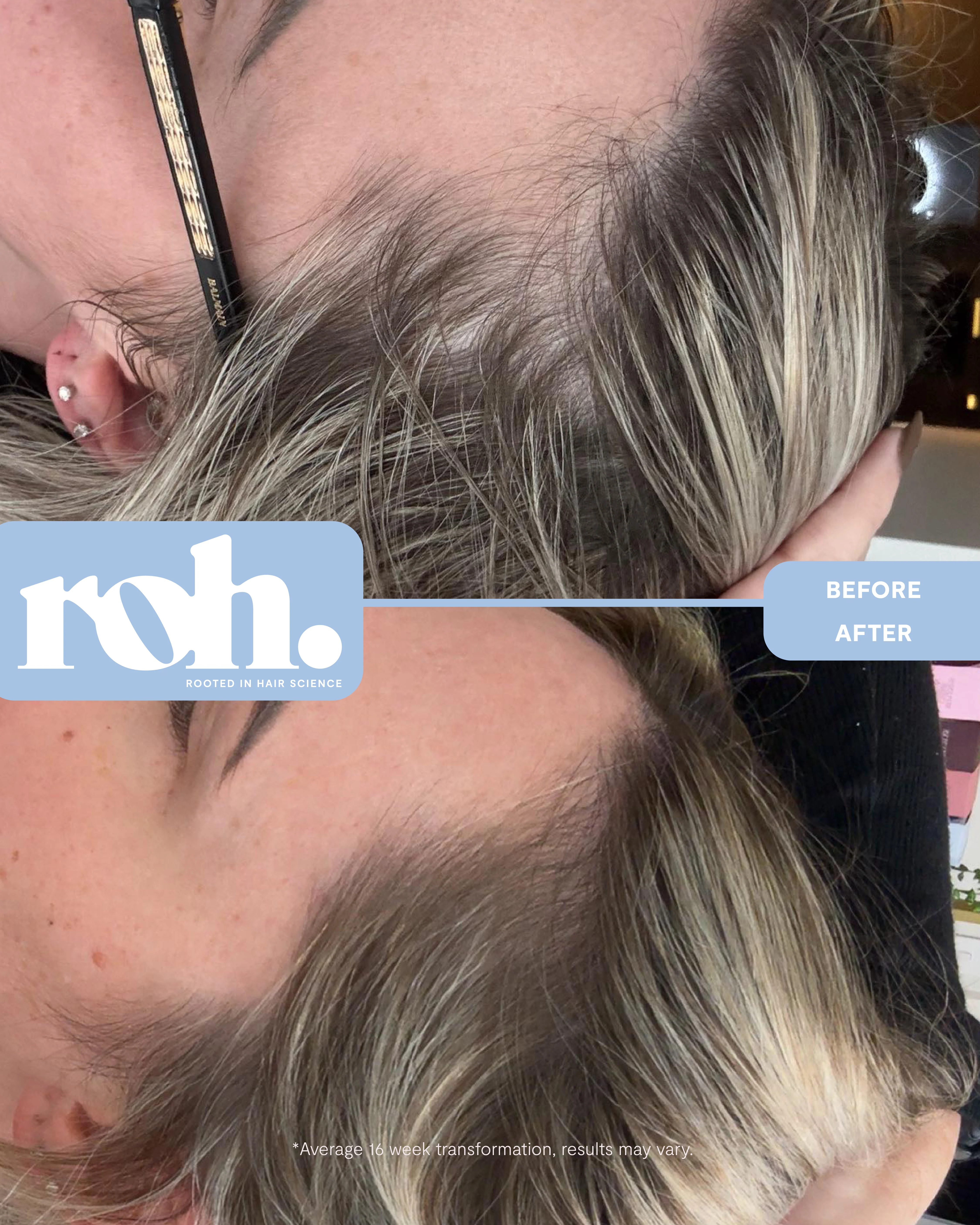 Scalp Renew Serum - Image 11