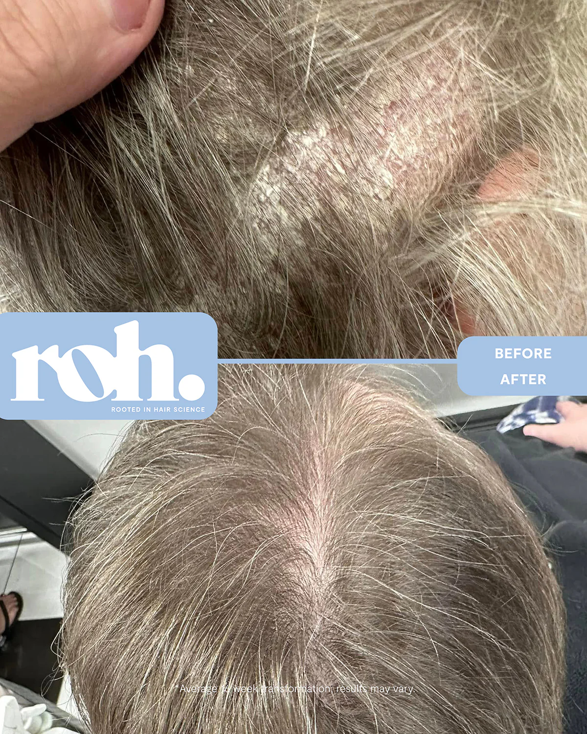 Scalp Renew Serum - Image 12